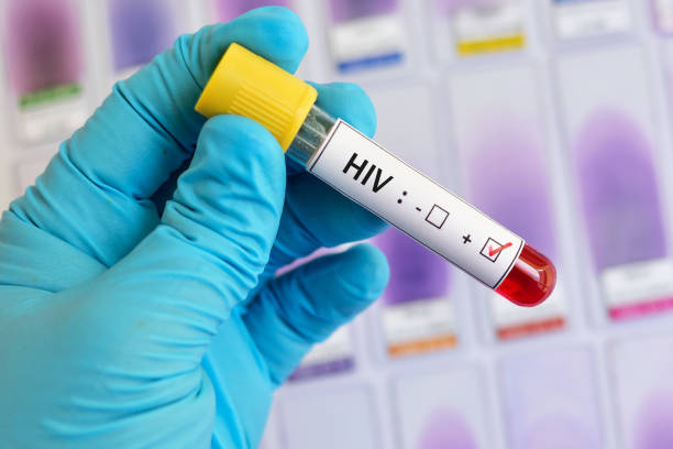 HIV Testing and Counselling Camp Draws Strong Turnout